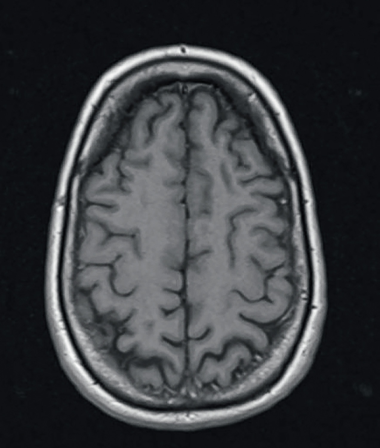 Hirnscan